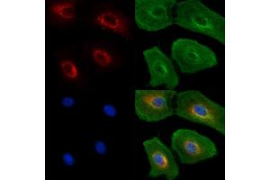 ABIN6262924 and ABIN6277599 staining  cells(UV treatment) by IF/ICC.