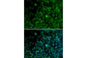 Immunofluorescence analysis of U2OS cells using IRF4 antibody (ABIN5970412).