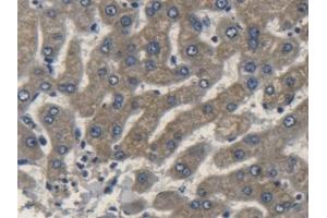 Detection of APOL2 in Human Liver Tissue using Polyclonal Antibody to Apolipoprotein L2 (APOL2) (Apolipoprotein L 2 antibody  (AA 186-337))
