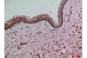 Immunohistochemistry (IHC) analysis of paraffin-embedded Human Skin, antibody was diluted at 1:100. (IL-1 beta antibody  (Internal Region))