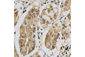 Immunohistochemistry of paraffin-embedded human stomach using MAPK10 antibody at dilution of 1:200 (x400 lens)