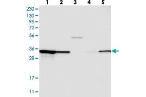 Western blot analysis of Lane 1: RT-4, Lane 2: U-251 MG, Lane 3: Human Plasma, Lane 4: Liver, Lane 5: Tonsil with STARD10 polyclonal antibody . (STARD10 antibody)