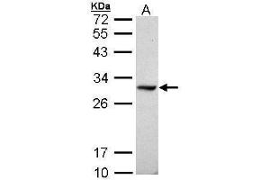 WB Image Sample (30 ug of whole cell lysate) A: Raji 12% SDS PAGE antibody diluted at 1:1000 (DDAH1 antibody  (C-Term))