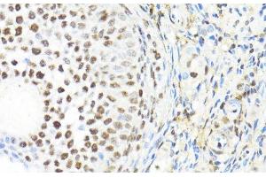 Immunohistochemistry of paraffin-embedded Rat ovary using BACH1 Polyclonal Antibody at dilution of 1:100 (40x lens). (BACH1 antibody)