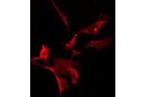 ABIN6275573 staining HuvEc by IF/ICC. (SLC6A8 antibody  (C-Term))