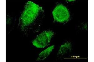 Image no. 1 for anti-B-Cell Receptor-Associated Protein 29 (BCAP29) (AA 125-241) antibody (ABIN599278) (BCAP29 antibody  (AA 125-241))