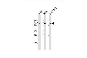 All lanes : Anti-PLAG1 Antibody (N-term) at 1:2000 dilution Lane 1: A431 whole cell lysate Lane 2: Hela whole cell lysate Lane 3: U-87 MG whole cell lysate Lysates/proteins at 20 μg per lane.