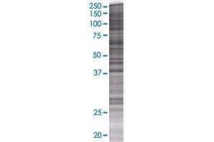 PPM1K transfected lysate. (PPM1K 293T Cell Transient Overexpression Lysate(Denatured))
