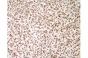 IHC analysis of HNRNPD using anti-HNRNPD antibody (ABIN7602590).