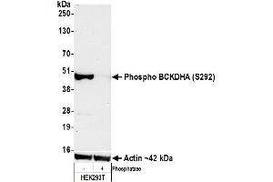 Western Blotting (WB) image for anti-Branched Chain Keto Acid Dehydrogenase E1, alpha Polypeptide (BCKDHA) (pSer292) antibody (ABIN7795621)