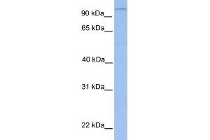 WB Suggested Anti-LPIN1 Antibody Titration: 0. (Lipin 1 antibody  (N-Term))