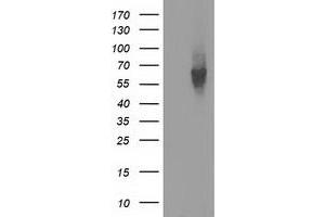 HEK293T cells were transfected with the pCMV6-ENTRY control (Left lane) or pCMV6-ENTRY EXD1 (Right lane) cDNA for 48 hrs and lysed. (EXD1 antibody)