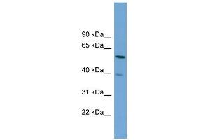 WB Suggested Anti-TOM1 Antibody Titration: 0. (TOM1 antibody  (Middle Region))