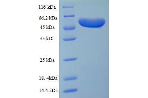 SDS-PAGE (SDS) image for Major Outer Membrane Protein (MOMP) (AA 24-389) protein (His-SUMO Tag) (ABIN5710880) (MOMP Protein (AA 24-389) (His-SUMO Tag))