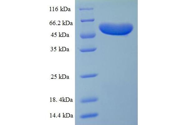 MOMP Protein (AA 24-389) (His-SUMO Tag)