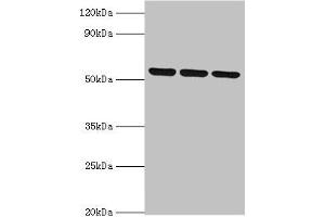 Western blot All lanes: MYOT antibody at 2 μg/mL Lane 1: 293T whole cell lysate Lane 2: HepG2 whole cell lysate Lane 3: Mouse skeletal muscle tissue Secondary Goat polyclonal to rabbit IgG at 1/10000 dilution Predicted band size: 56, 36 kDa Observed band size: 56 kDa (Myotilin antibody  (AA 443-498))
