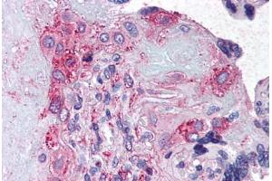 Anti-ADAMTS5 antibody  ABIN1048294 IHC staining of human placenta.