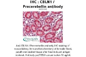 Image no. 3 for anti-Cerebellin 1 Precursor (CBLN1) antibody (ABIN1732717)
