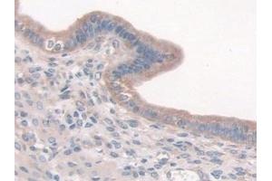 Detection of CTTN in Mouse Uterus Tissue using Polyclonal Antibody to Cortactin (CTTN) (Cortactin antibody  (AA 1-509))