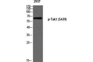 Western Blot (WB) analysis of 293T using p-Tak1 (S439) antibody. (TR4 antibody  (pSer439))