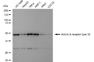 Western blotting analysis using Activin A receptor type 1B antibody (ABIN7797491).