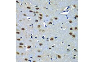 Immunohistochemistry of paraffin-embedded rat brain using P antibody (ABIN6132463, ABIN6145262, ABIN6145264 and ABIN6216484) at dilution of 1:100 (40x lens). (PAX7 antibody  (AA 289-518))