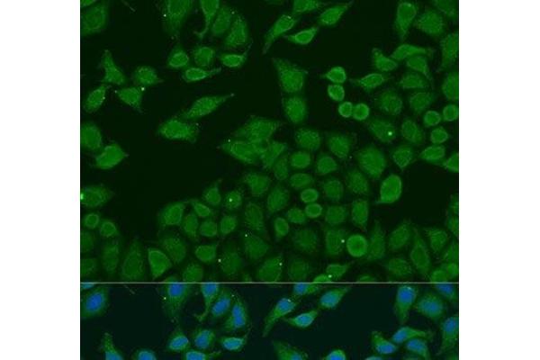 PLA2G4C antibody