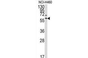Western Blotting (WB) image for anti-Matrix Metallopeptidase 17 (Membrane-inserted) (MMP17) antibody (ABIN3002547) (MMP17 antibody)