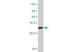 Western Blot detection against Immunogen (34. (IL23R antibody  (AA 553-628))