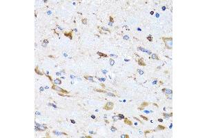Immunohistochemistry of paraffin-embedded mouse spinal cord using PTRH2 antibody.