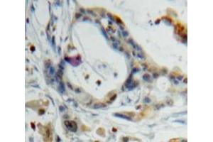 Used in DAB staining on fromalin fixed paraffin-embedded Pancreas tissue (PPY antibody  (AA 30-87))