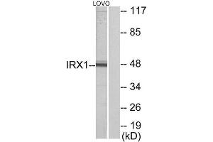 Western Blotting (WB) image for anti-Iroquois Homeobox Protein 1 (IRX1) (Internal Region) antibody (ABIN1849496)