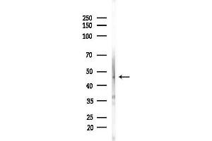 anti-5-Azacytidine Induced 2 (AZI2) (N-Term) antibody