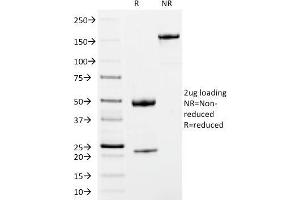 SDS-PAGE Analysis Purified IgM Mouse Monoclonal Antibody (IM373). (IGHM antibody)