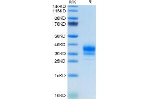 Human FOLR2 on Tris-Bis PAGE under reduced condition. (FOLR2 Protein (AA 17-228) (His tag))