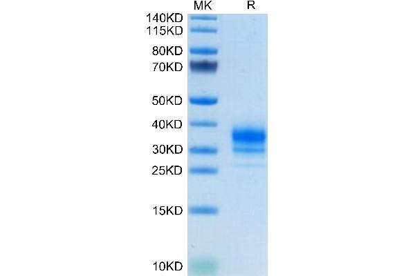 FOLR2 Protein (AA 17-228) (His tag)