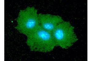 ICC/IF analysis of SAR1B in Hep3B cells line, stained with DAPI (Blue) for nucleus staining and monoclonal anti-human SAR1B antibody (1:100) with goat anti-mouse IgG-Alexa fluor 488 conjugate (Green). (SAR1B antibody  (AA 1-198))