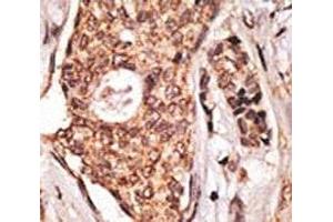 Immunohistochemistry (IHC) image for anti-Inducible T-Cell Co-Stimulator (ICOS) (AA 156-185) antibody (ABIN3028725)