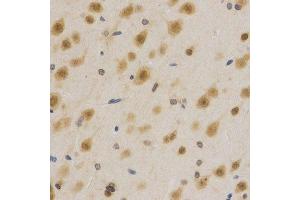 Immunohistochemistry (Paraffin-embedded Sections) (IHC (p)) image for anti-ELAV (Embryonic Lethal, Abnormal Vision, Drosophila)-Like 1 (Hu Antigen R) (ELAVL1) (AA 1-326) antibody (ABIN3022231)