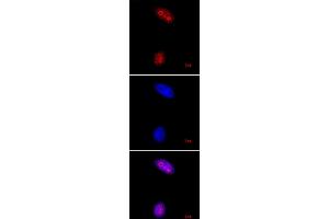 Histone H3K27me3 pAb tested by immunofluorescence. (Histone 3 antibody  (3meLys27))