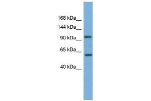 Western Blot showing PI4KB antibody used at a concentration of 1-2 ug/ml to detect its target protein. (PI4KB antibody  (Middle Region))