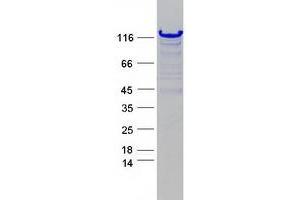 Validation with Western Blot (NADAP Protein (Myc-DYKDDDDK Tag))