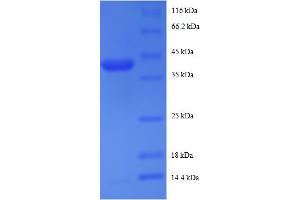 SDS-PAGE (SDS) image for Ribosomal Protein S19 Binding Protein 1 (RPS19BP1) (AA 1-145), (full length) protein (GST tag) (ABIN5712077) (RPS19BP1 Protein (AA 1-145, full length) (GST tag))