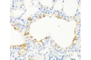 Immunohistochemistry of paraffin-embedded Mouse bronchus using MAPRE3 Polyclonal Antibody at dilution of 1:100 (40x lens). (MAPRE3 antibody)