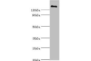 Western blot All lanes: CFH antibody at 3 μg/mL + human serum Secondary Goat polyclonal to rabbit IgG at 1/10000 dilution Predicted band size: 140, 52 kDa Observed band size: 140 kDa (Complement Factor H antibody  (AA 20-270))