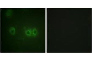 Immunofluorescence analysis of HuvEc cells, using MRLC2 (Ab-18) Antibody.