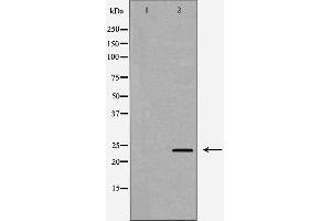 Western blot analysis of A431 cell lysate, using IL24 Antibody.