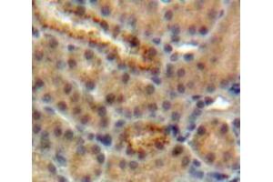 Used in DAB staining on fromalin fixed paraffin-embedded Kidney tissue (CST5 antibody  (AA 21-142))