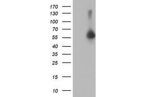 HEK293T cells were transfected with the pCMV6-ENTRY control (Left lane) or pCMV6-ENTRY AKT1 (Right lane) cDNA for 48 hrs and lysed. (AKT1 antibody)