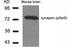 Image no. 1 for anti-Synapsin I (SYN1) (pSer9) antibody (ABIN197030) (SYN1 antibody  (pSer9))